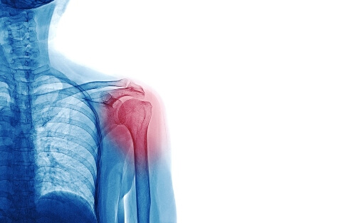 Exercise rehabilitation for various conditions